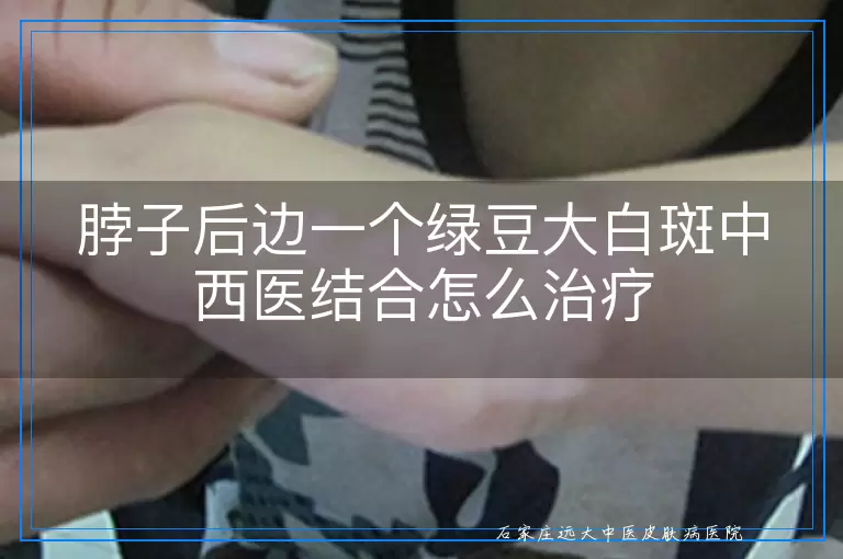 脖子后边一个绿豆大白斑中西医结合怎么治疗