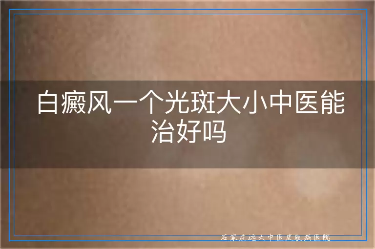 白癜风一个光斑大小中医能治好吗