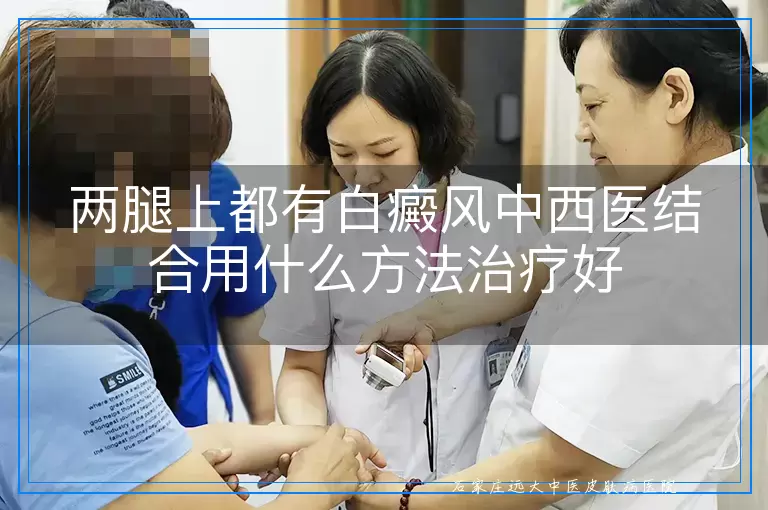 两腿上都有白癜风中西医结合用什么方法治疗好