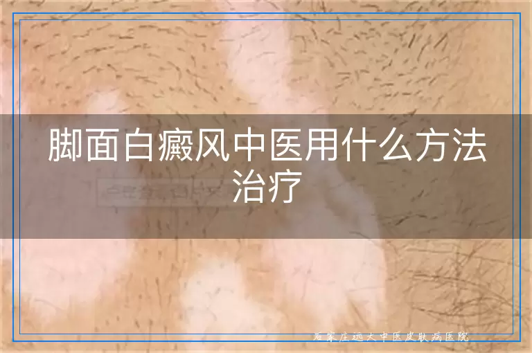 脚面白癜风中医用什么方法治疗