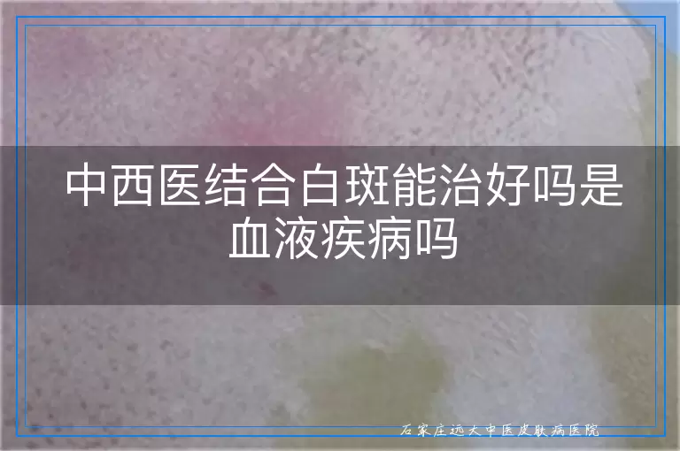 中西医结合白斑能治好吗是血液疾病吗