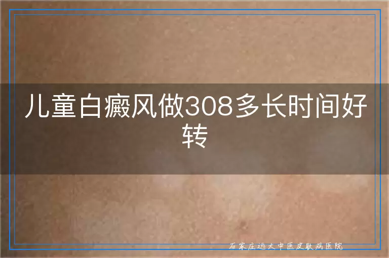 儿童白癜风做308多长时间好转