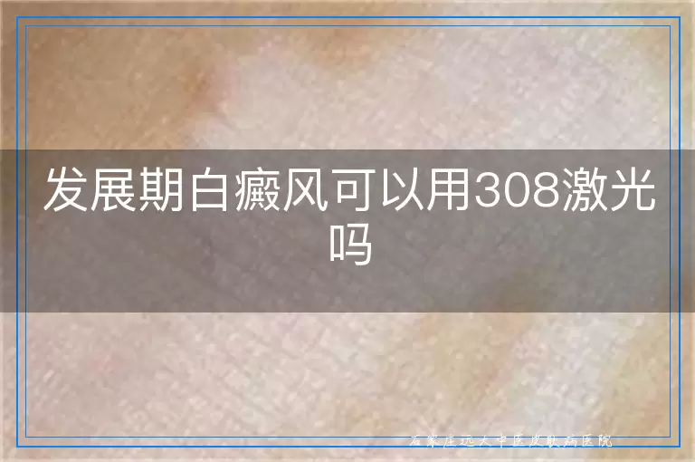 发展期白癜风可以用308激光吗