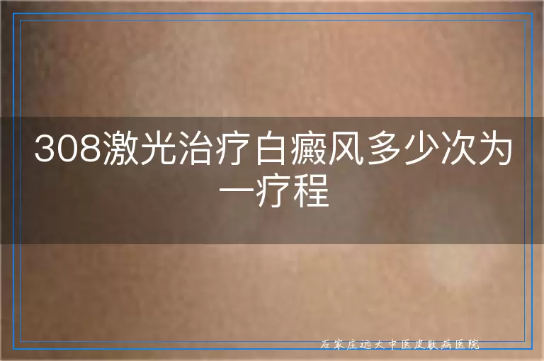 308激光治疗白癜风多少次为一疗程