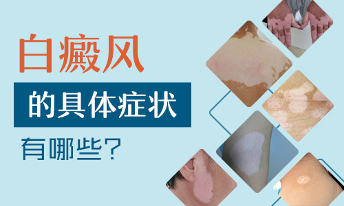 儿童胸部有白点抹他克莫司多久能好