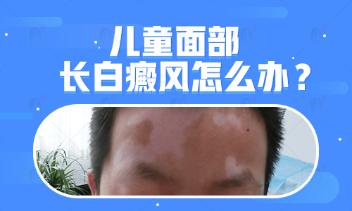孩子身上有鸡蛋大白斑进口308激光怎么治疗