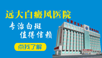孕妇患白癜风扩散了要不要用药