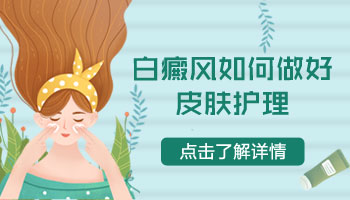 发展期白癜风抹什么药能控制其不发展