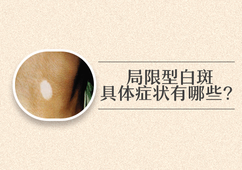 婴儿身上有白点多久照一次激光效果好