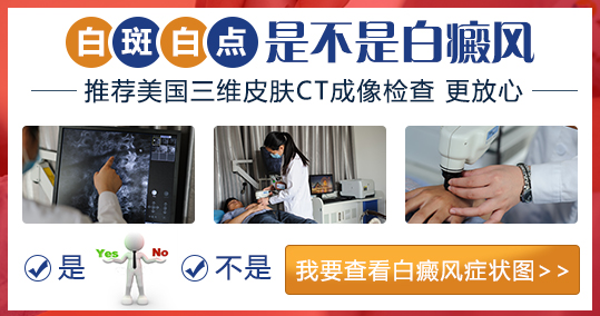 儿童腰部有白斑照UVB能治得好吗