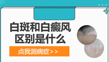 小孩身上长硬币大白斑抹他克莫司多久能好