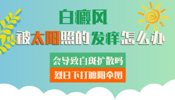 发展期白癜风吃药控制不住怎么治疗能行