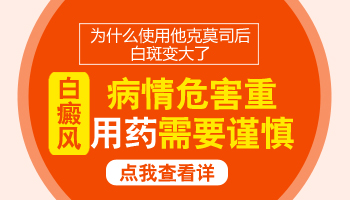 四肢上白癜风反反复复有什么好的方法控制