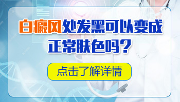 白癜风扩大了有什么好的控制方法