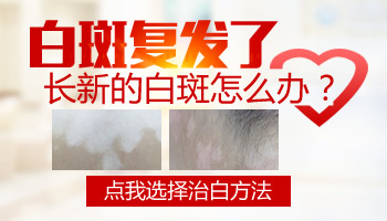 儿童后背有白斑怎么治疗科学