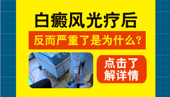 儿童胸部巴掌大白斑一天照几次激光比较合适