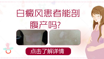 孩子身上长米粒大白点只照uvb光能控制住吗