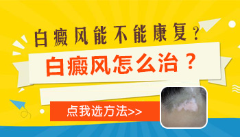 儿童腹部有白斑怎么治疗有康复案例吗