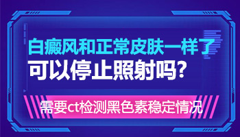 处在发展期的白点照激光几次能控制住