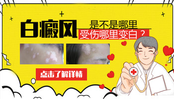 小孩身上有鸡蛋大白斑怎么用药好的快