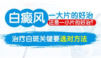 手上的白癜风好几年没扩散可以不治吗