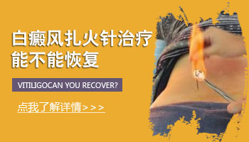 uvb跟卡泊三醇同用可治白斑吗