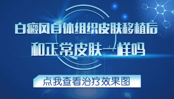 白癜风扩大了有什么好的控制方法