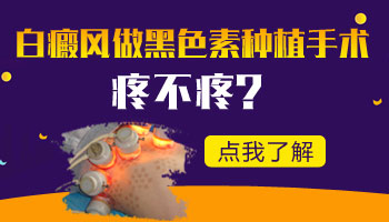 儿童腰部长白癜风抹药膏效果怎么样
