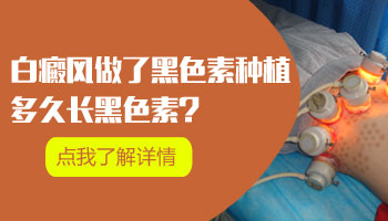 儿童面部巴掌大白斑照308激光能治好吗