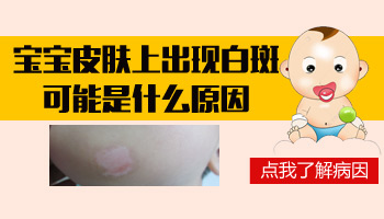 白癜风处在发展期喝中药治疗多久能见到好转