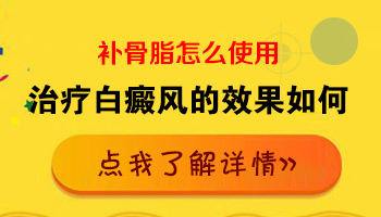 发展期白癜风怎么用药恢复的快一些