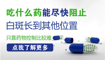 小孩身上有一片白照308激光能治好吗