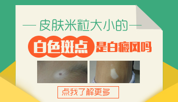 儿童额头有片白做308激光照多长时间合适