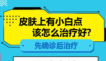 孩子身上出现小白块怎么治疗 有康复案例吗