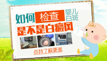 婴儿身上出白块照308多久能看到效果