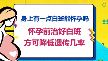 发展期白癜风照uvb光疗能治疗好吗