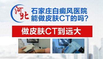 婴儿身上发现米粒大白斑只照uvb光能控制住吗