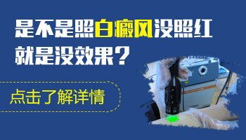 儿童腿上长白癜风照308激光变黑还继续照吗