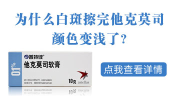 儿童腹部有白块照UVB能治得好吗