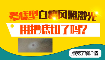 儿童肩膀有白块照308激光发痒怎么回事