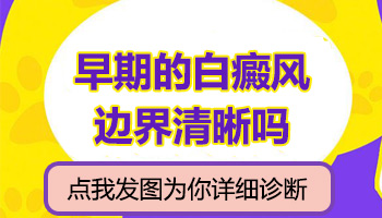 儿童后背有白点一直扩散用什么方法控制