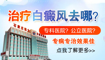 uvb跟卡泊三醇同用可治白斑吗