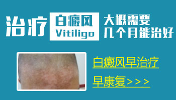 儿童面部有片白照308激光发痒怎么回事