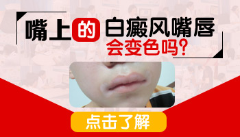 白癜风吃药抹药三个月没变化怎么回事