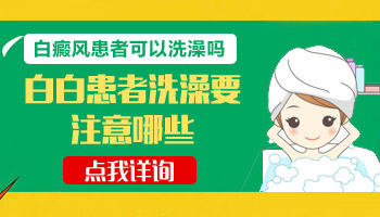 儿童脖颈巴掌大白斑中西医结合治疗怎么样