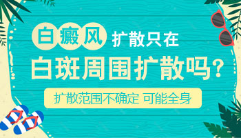 发展期白癜风怎么形成的，白斑怎么治疗
