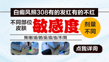 儿童腿上长白癜风照308激光变黑还继续照吗