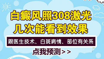 吃什么药控制白癜风不发展效果好