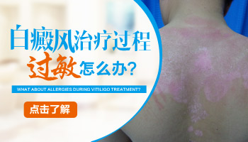 儿童肩膀有白块照308激光发痒怎么回事