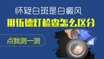 儿童肩膀巴掌大白斑照308起泡了怎么办